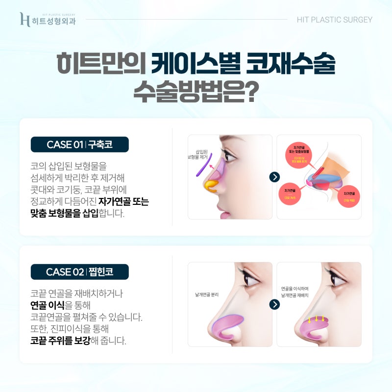 [히트성형외과] 아름다움과 기능까지, 만족스러운 코재수술 사진 3