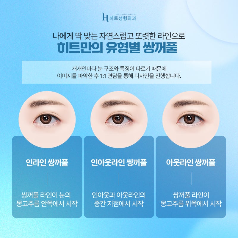 [히트성형외과] 나에게 맞는 쌍꺼풀 수술법은 뭘까 궁금하다면? 사진 5