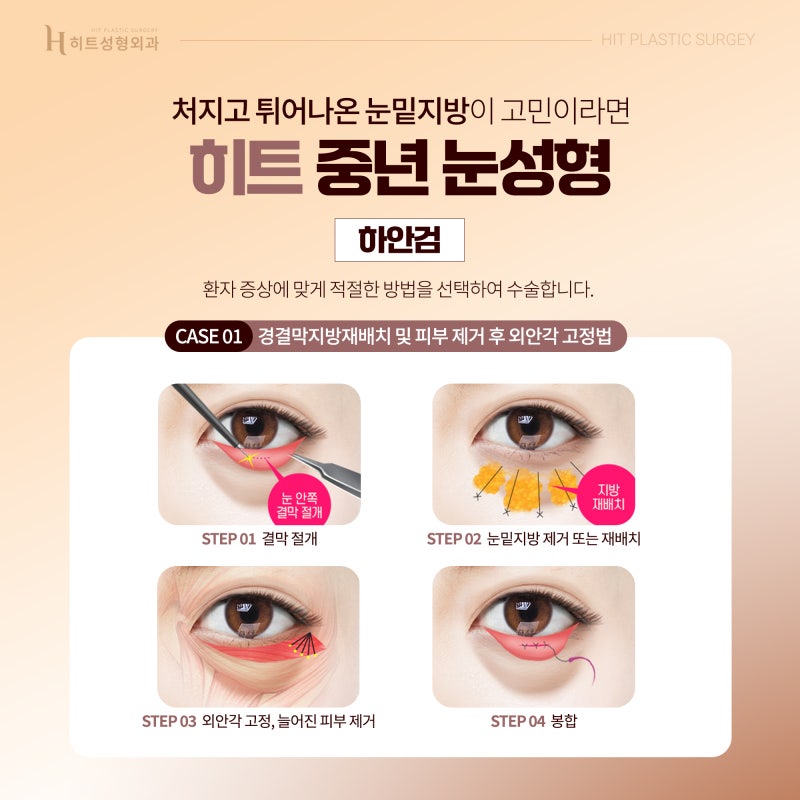 [히트성형외과] 중년 눈성형이 중요한 이유 사진 3
