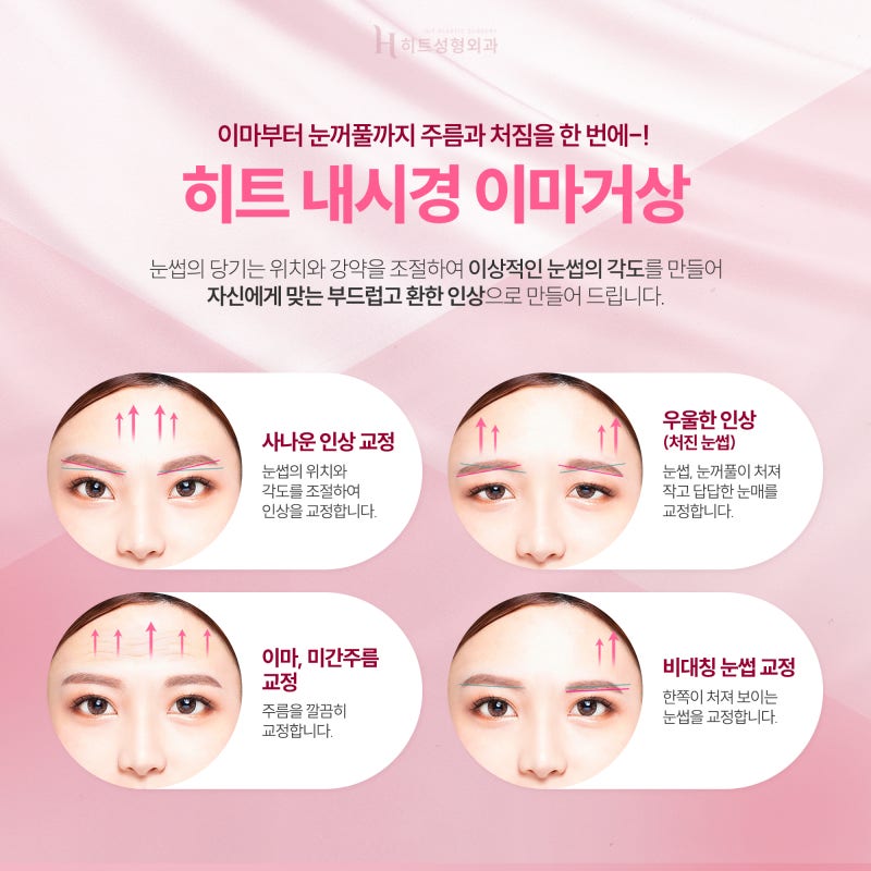 [히트성형외과] 이마부터 눈꺼풀까지 한번에, 내시경 이마거상 사진 2