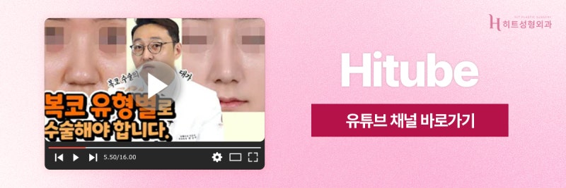 [히트성형외과] 복코 성형, 슬림하면서 더 오똑하게 사진 8