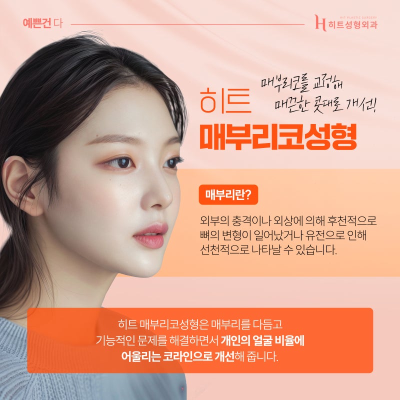 [히트성형외과] 부드러운 인상을 위한 매부리코 성형