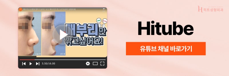 [히트성형외과] 부드러운 인상을 위한 매부리코 성형 사진 8