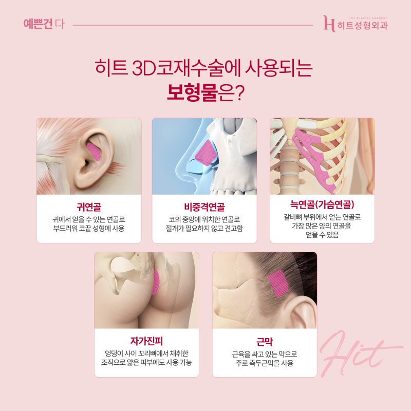 [히트성형외과] 오직 나를 위한 맞춤 보형물, 3D프린팅 코재수술 사진 5