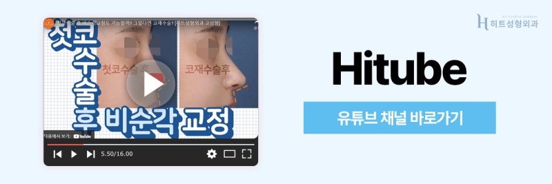 [히트성형외과] 이상적인 코 라인을 위한 히트 비순각 교정 사진 8