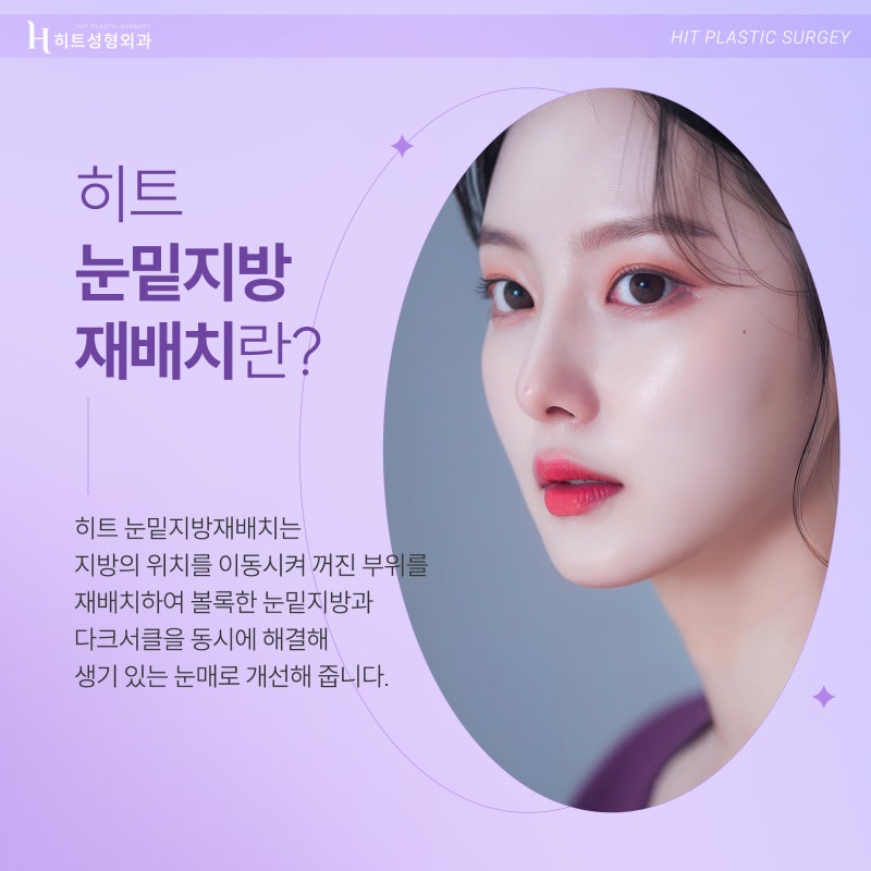 [히트성형외과] 어둡고 칙칙한 눈매 개선법, 히트 눈밑지방재배치 사진 2