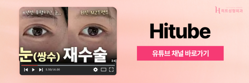 [히트성형외과] 트임 성형, 보다 더 시원한 눈매로 사진 9