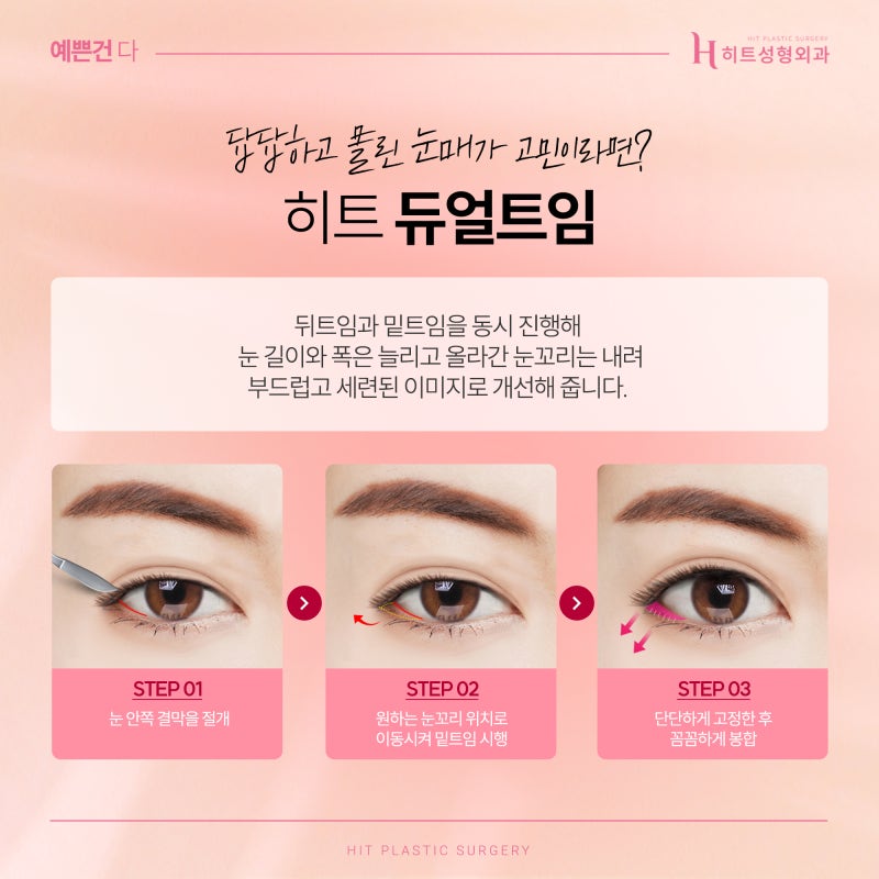 [히트성형외과] 트임 성형, 보다 더 시원한 눈매로 사진 6