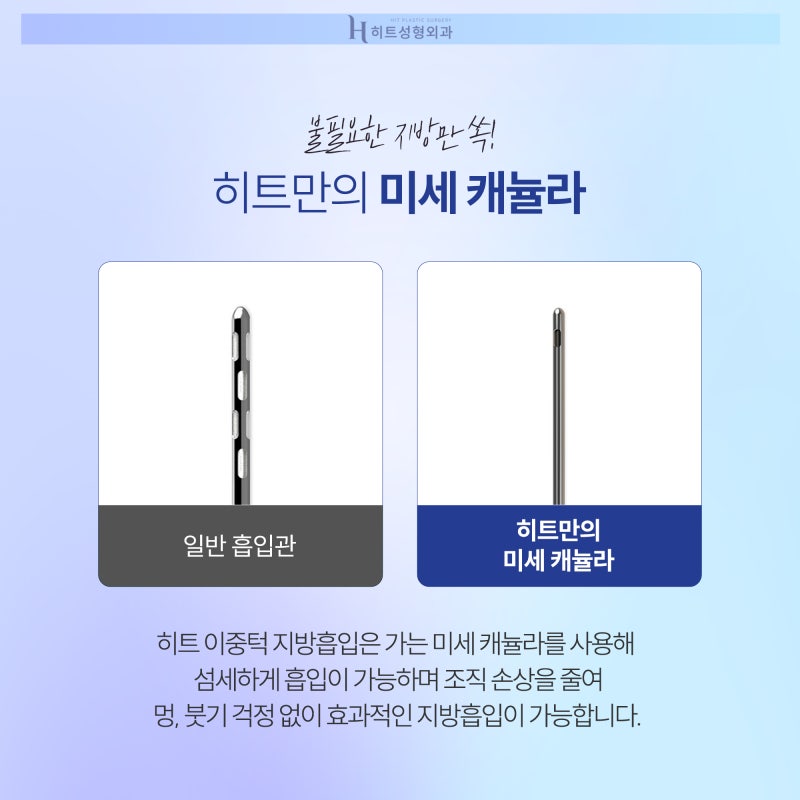 [히트성형외과] 이중턱 지방흡입을 고민하고 있다면 사진 4