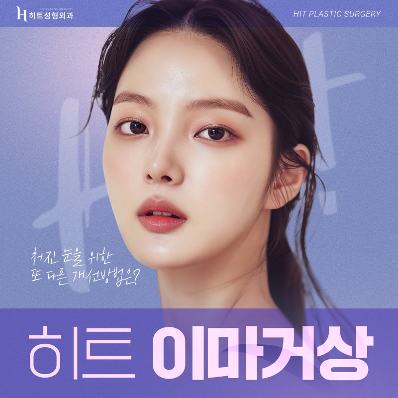 [히트성형외과] 처진 눈을 위한 또 다른 개선방법, 히트 이마거상
