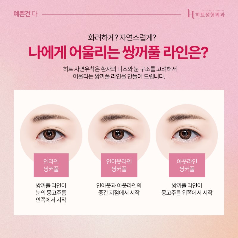 [히트성형외과] 자연유착 쌍꺼풀 더욱 또렷하고 자연스럽게! 사진 5