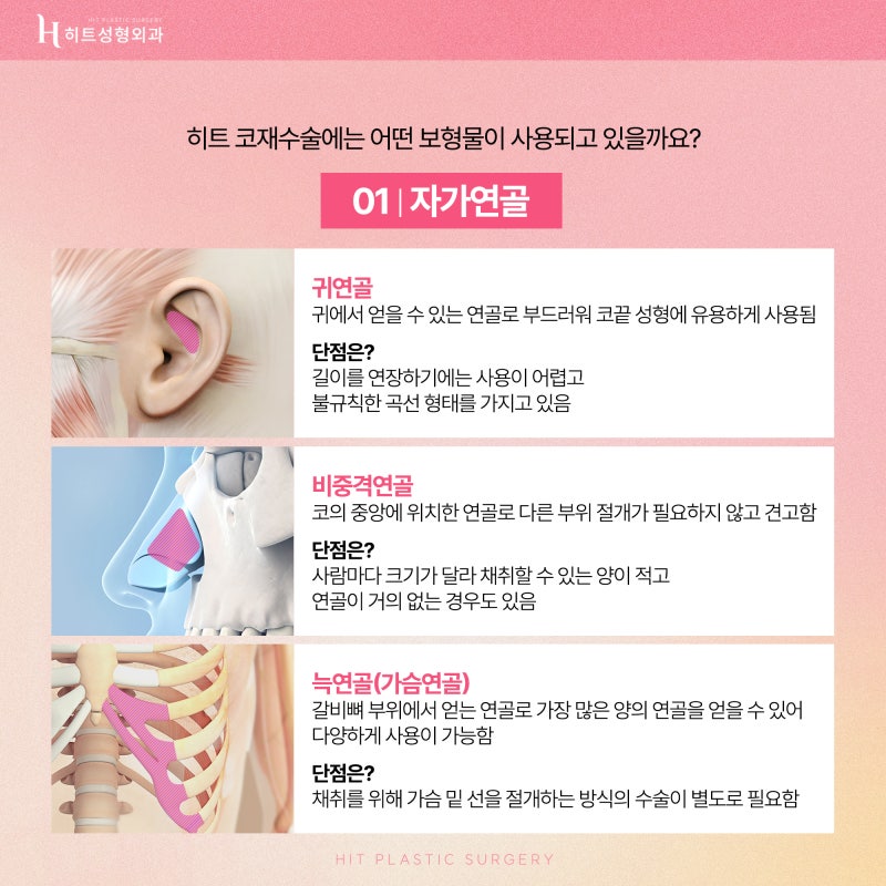 [히트성형외과] 성공적인 코재수술을 위한 각 보형물 별 장단점 사진 3