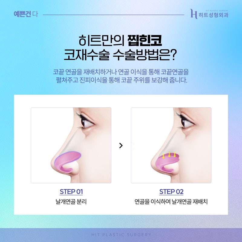 [히트성형외과] 찝힌코로 인한 코재수술 사진 3