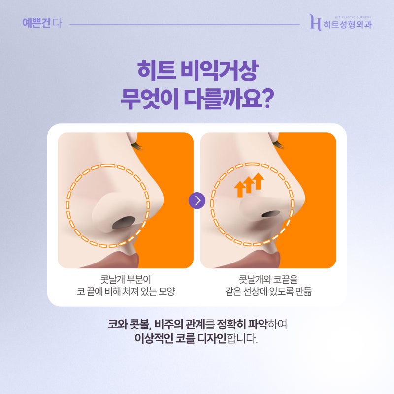 [히트성형외과] 이상적인 콧볼과 코끝을 위한 히트 비익거상 사진 3