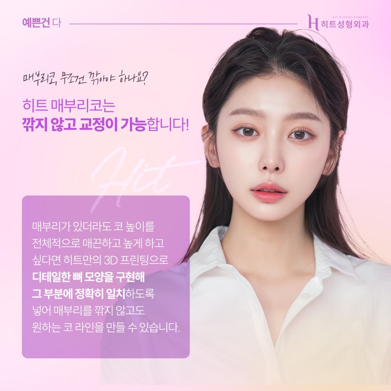 [히트성형외과] 코 뼈를 깎지 않는 매부리코 수술법!