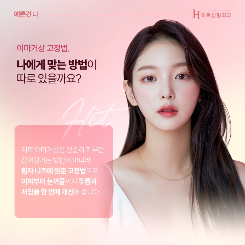 [히트성형외과] 이마거상 어떤 고정법이 나에게 맞을까?