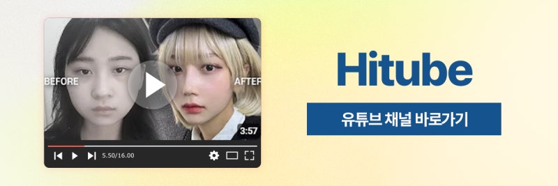 [히트성형외과] 남자들의 이중턱 고민, 히트 얼굴지방흡입으로 더 세련되게 사진 8