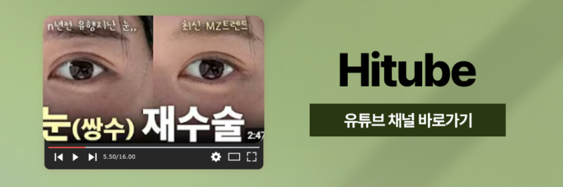 [히트성형외과] 히트 트임성형으로 시원하고 또렷하게! 사진 8