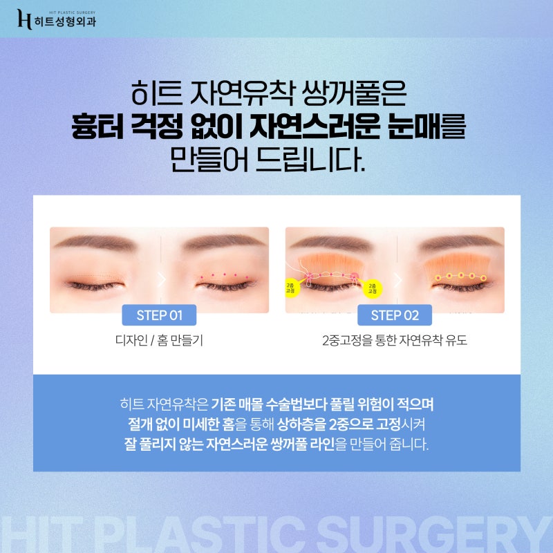 [히트성형외과] 쌍꺼풀 수술, 눈매교정 어떤 차이가 있을까? 사진 3