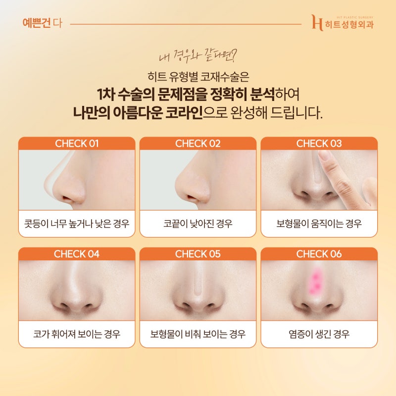 [히트성형외과] 코재수술 유형은 어떤 것들이 있을까? 사진 4