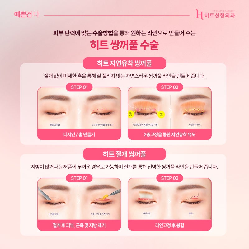 [히트성형외과] 눈성형, 연령대별로 알아보자! 사진 3