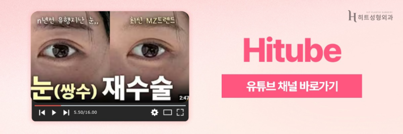 [히트성형외과] 눈성형, 연령대별로 알아보자! 사진 8