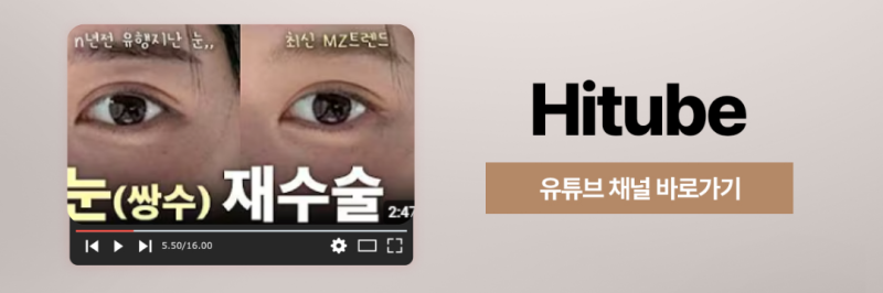 [히트성형외과] 강아지 눈매 VS 고양이 눈매 원하는 느낌에 따라! 사진 8