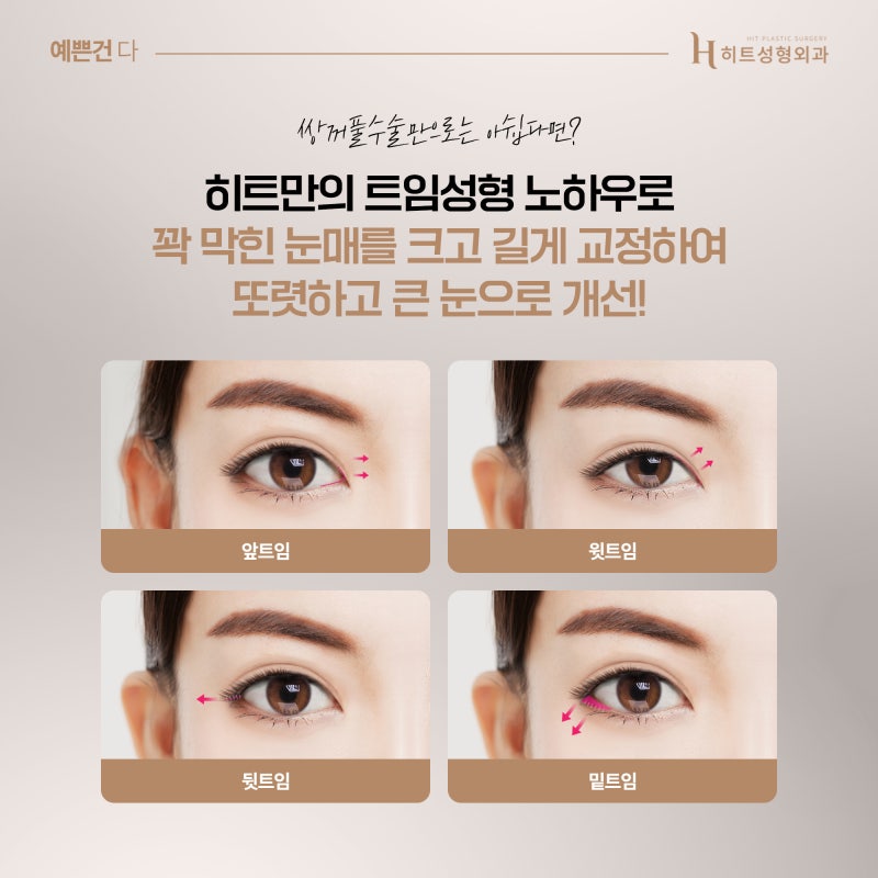 [히트성형외과] 강아지 눈매 VS 고양이 눈매 원하는 느낌에 따라! 사진 5