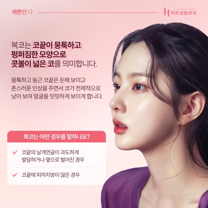 [히트성형외과] 복코, 콧볼 축소만으로 개선이 가능할까?