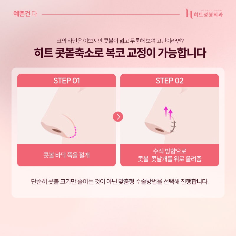 [히트성형외과] 복코, 콧볼 축소만으로 개선이 가능할까? 사진 3