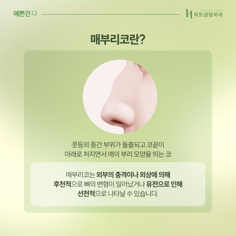 [히트성형외과] 매부리코 종류별 특징은?