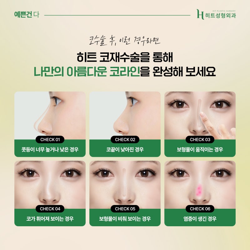 [히트성형외과] 코재수술, 골든타임은 언제일까요? 사진 3