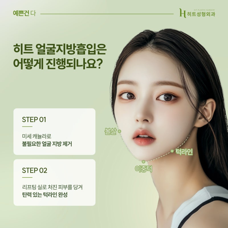 [히트성형외과] 짧은턱, 무턱, 이중턱지방흡입으로 교정하기! 사진 4