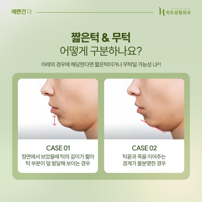 [히트성형외과] 짧은턱, 무턱, 이중턱지방흡입으로 교정하기!