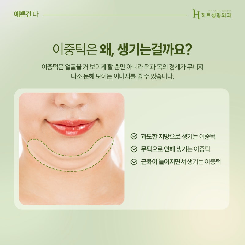 [히트성형외과] 짧은턱, 무턱, 이중턱지방흡입으로 교정하기! 사진 3
