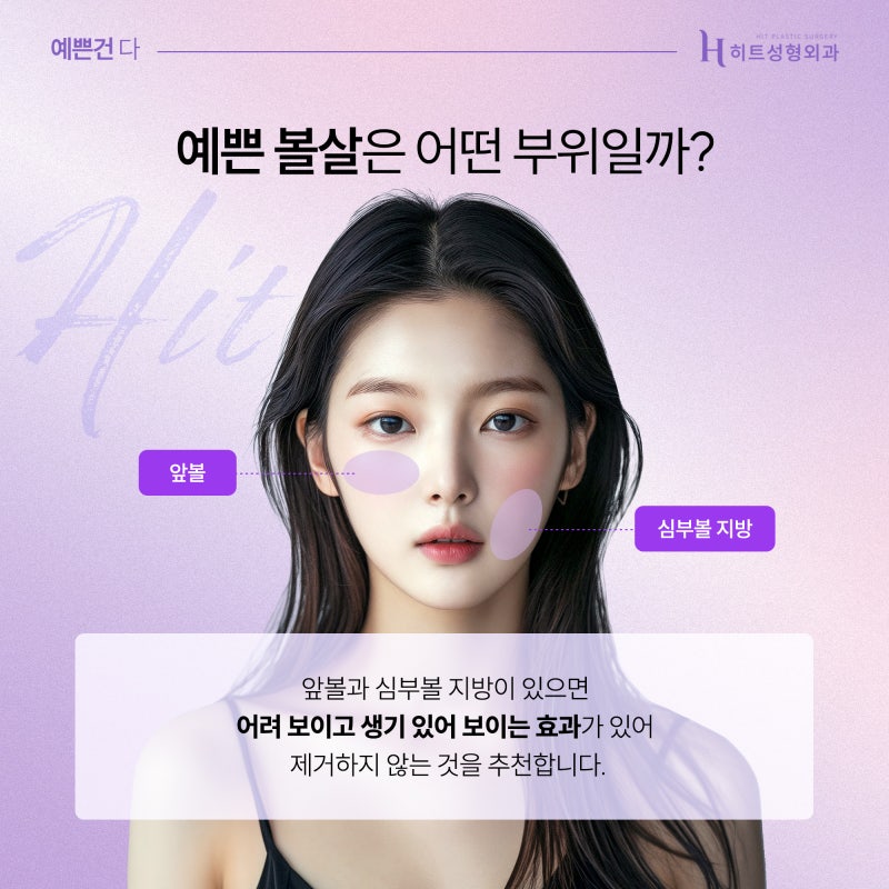 [히트성형외과] 볼살에도 예쁜볼살, 미운볼살이 있다?! 사진 3