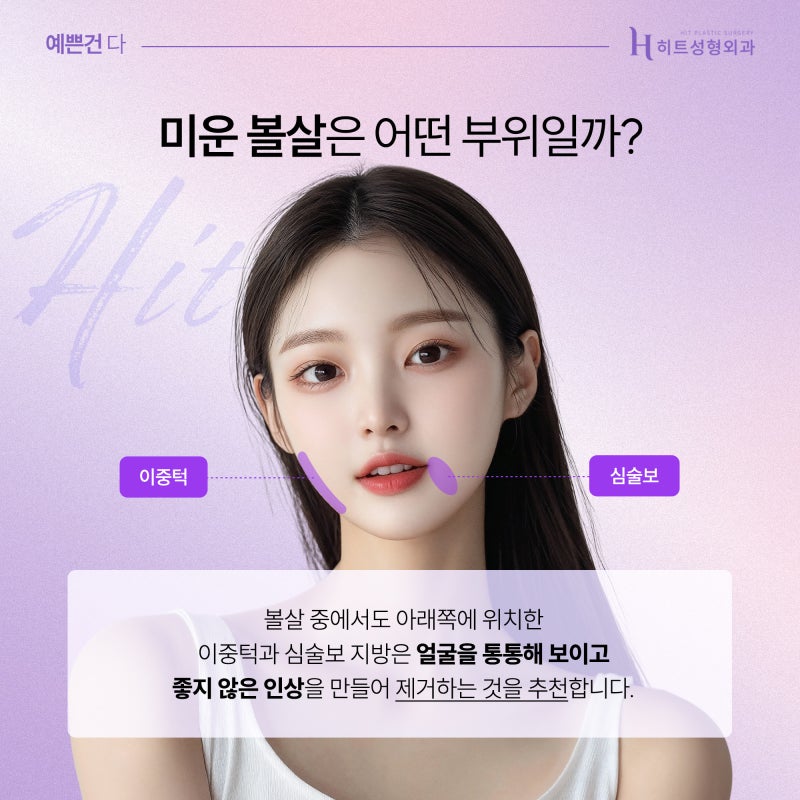 [히트성형외과] 볼살에도 예쁜볼살, 미운볼살이 있다?! 사진 4