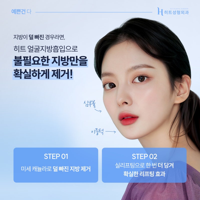 [히트성형외과] 이중턱지방흡입 재수술 케이스는? 사진 3