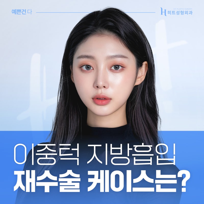 [히트성형외과] 이중턱지방흡입 재수술 케이스는?