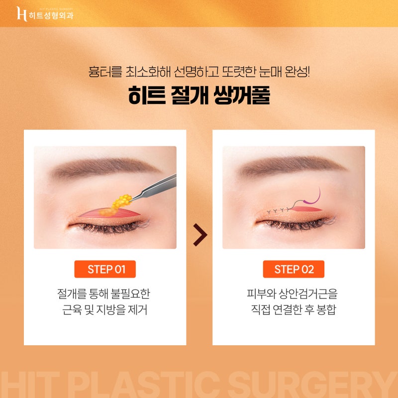 [히트성형외과] 히트 쌍꺼풀 수술의 모든 것! 사진 5