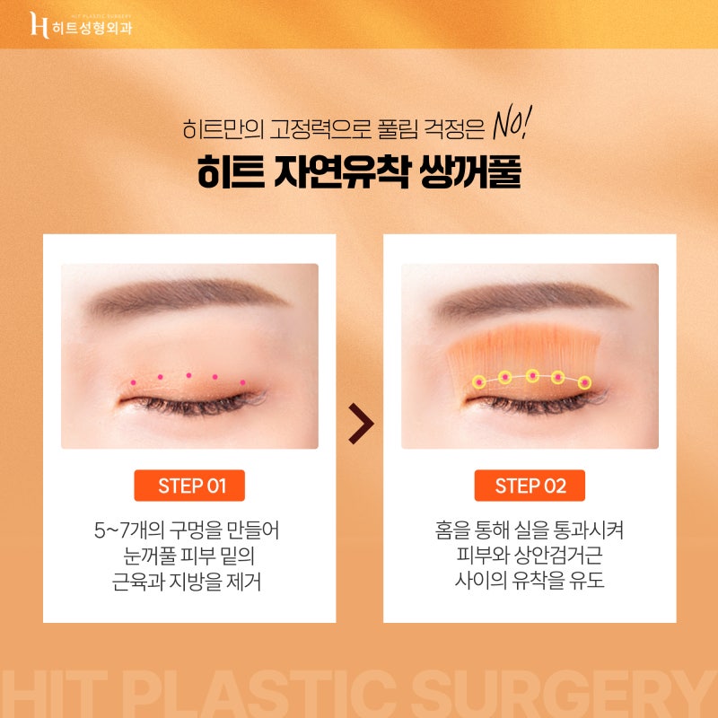 [히트성형외과] 히트 쌍꺼풀 수술의 모든 것! 사진 3