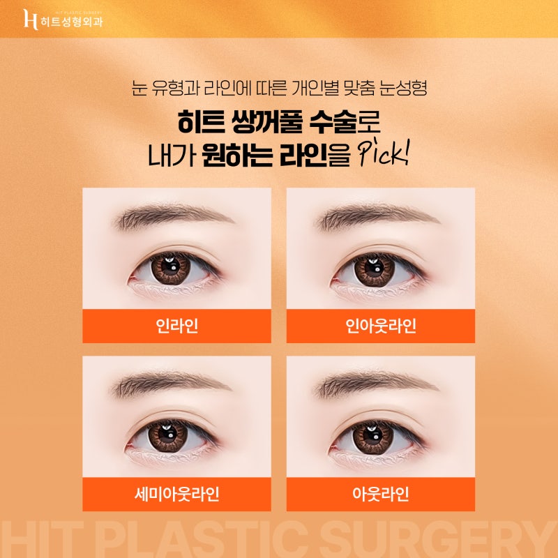 [히트성형외과] 히트 쌍꺼풀 수술의 모든 것!