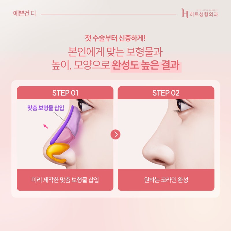 [히트성형외과] 코 성형 계획이 있다면 꼭 읽어보세요! 사진 5