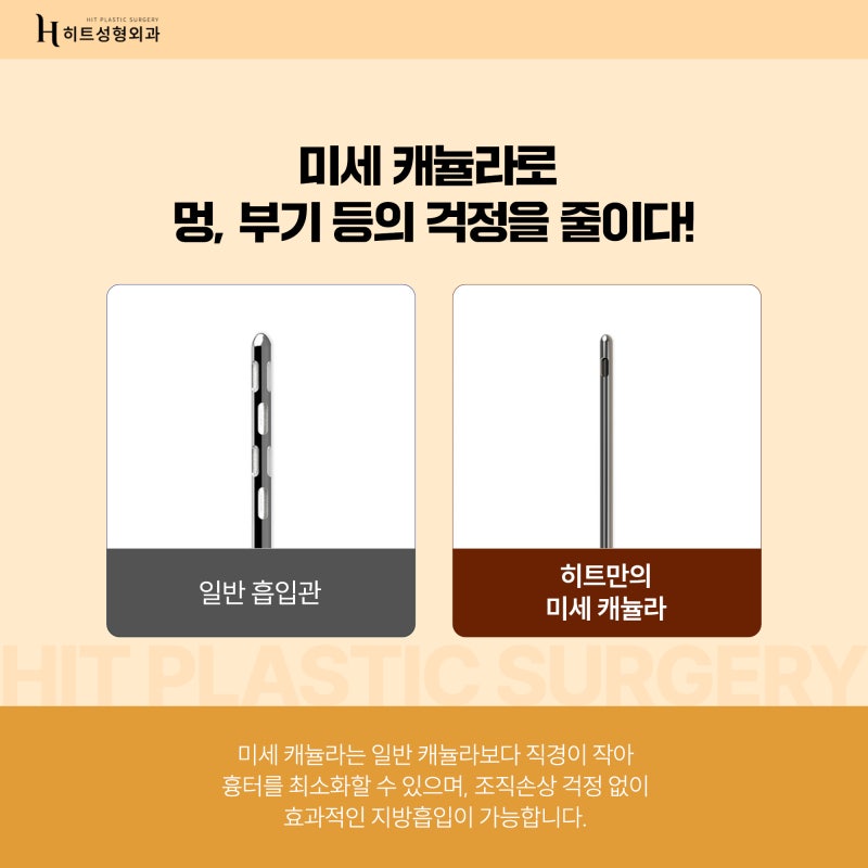 [히트성형외과] 히트만의 3 V-ZONE 핸드메이드 얼굴 지방흡입 사진 3