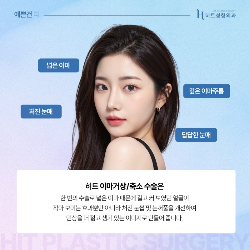[히트성형외과] 이마거상과 축소를 한 번에! 사진 4