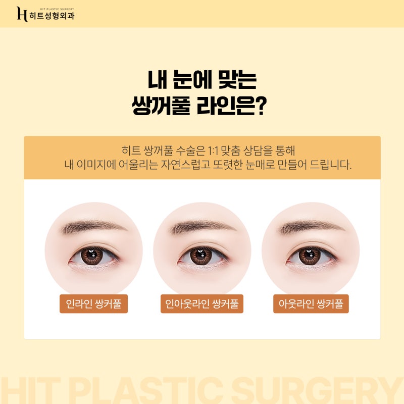 [히트성형외과] 나에게 맞는 쌍꺼풀 라인의 높이는? 사진 4