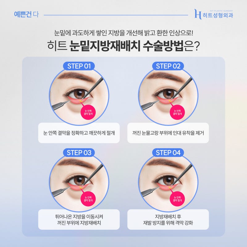 [히트성형외과] 히트만의 대표적인 동안 성형은? 사진 3