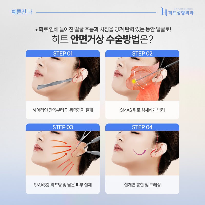 [히트성형외과] 히트만의 대표적인 동안 성형은? 사진 5