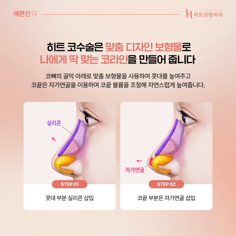 [히트성형외과] 코 수술 후 붓기를 빨리 빼는 방법은? 사진 4