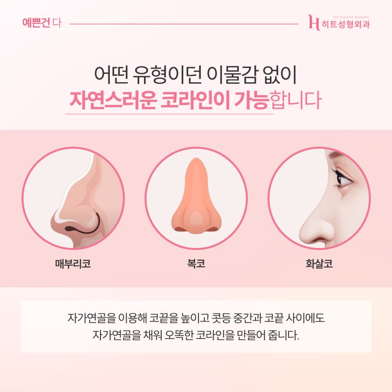 [히트성형외과] 무보형물 코 누구나 가능할까? 사진 4